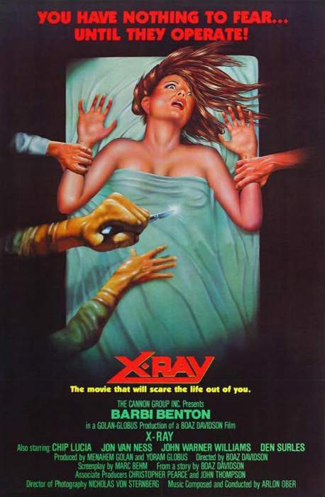 X-ray
